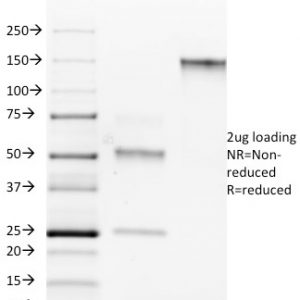 SDS-PAGE Analysis Purified ROR-gamma / RORC Mouse Monoclonal Antibody (RORC/2942). Confirmation of Purity and Integrity of Antibody.