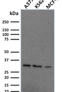 Western Blot Analysis of Human A375, K562, MCF-7 cell lysate using Replication Protein A2 Mouse Monoclonal Antibody (RPA2/2106).