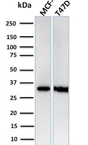 Western Blot Analysis of Human MCF-7, T47D cell lysates using RPA2 Recombinant Rabbit Monoclonal Antibody (RPA2/3140R).