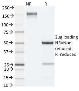 SDS-PAGE Analysis Purified IL-4 Rat Monoclonal Antibody (11B11). Confirmation of Integrity and Purity of Antibody.