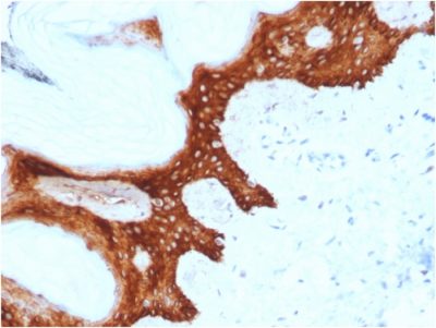 Formalin-fixed, paraffin-embedded human Skin stained with Stratifin Mouse Monoclonal Antibody (CPTC-SFN-2).