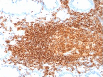 Formalin-fixed, paraffin-embedded human Lymph Node stained with CD45RB Recombinant Mouse Monoclonal Antibody (rPTPRC/1132).