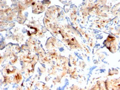 Formalin-fixed, paraffin-embedded human Placenta stained with S100A4 Recombinant Mouse Monoclonal Antibody (rS100A4/1481).