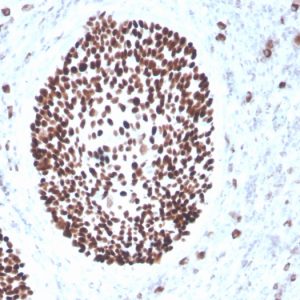 Formalin-fixed, paraffin-embedded human cervix stained with SOX2 Recombinant Mouse Monoclonal Antibody (rSOX2/1791).