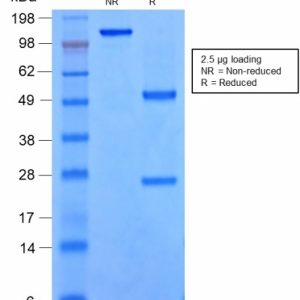 SDS-PAGE Analysis of Purified SOX9 Monoclonal Antibody (rSOX9/2288). Confirmation of Integrity and Purity of the Antibody.