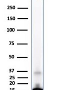 SDS-PAGE Analysis Purified Transthyretin Mouse Monoclonal Antibody (CPTC-TTR-1). Confirmation of Purity and Integrity of Antibody.
