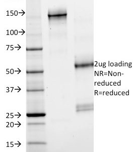 SDS-PAGE Analysis Purified SMAD4 Mouse Monoclonal Antibody (SMAD4/2524). Confirmation of Purity and Integrity of Antibody.