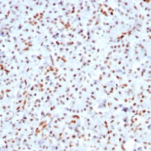 Formalin-fixed, paraffin-embedded human Pancreas stained with SOX9 Recombinant Rabbit Monoclonal Antibody (SOX9/3141R).