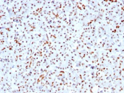 Formalin-fixed, paraffin-embedded human Pancreas stained with SOX9 Recombinant Rabbit Monoclonal Antibody (SOX9/3141R).
