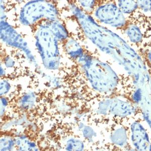 Formalin-fixed, paraffin-embedded human Placenta stained with Spectrin alpha 1 (SPTA1) Mouse Monoclonal Antibody (SPTA1/1810).