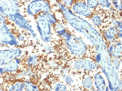 Formalin-fixed, paraffin-embedded human Placenta stained with Spectrin alpha 1 (SPTA1) Mouse Monoclonal Antibody (SPTA1/1810).