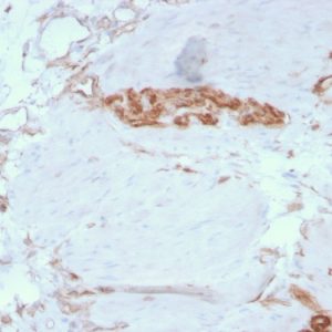 Formalin-fixed, paraffin-embedded human Colon stained with Fodrin Mouse Monoclonal Antibody (SPTAN1/3351).