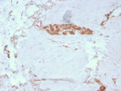 Formalin-fixed, paraffin-embedded human Colon stained with Fodrin Mouse Monoclonal Antibody (SPTAN1/3351).