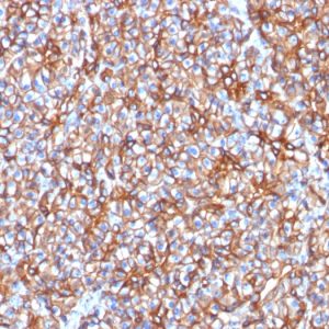 Formalin-fixed, paraffin-embedded human Pancreas stained with Spectrin beta III Mouse Monoclonal Antibody (SPTBN2/1778).