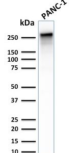 Western Blot Analysis of PANC-1 cell lysate using Spectrin beta III Rabbit Recombinant Monoclonal (SPTBN2/2887R).