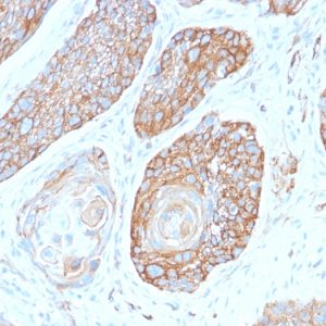 Formalin-fixed, paraffin-embedded human Pancreas stained with Spectrin Beta 3 Rabbit Monoclonal Antibody (SPTBN2/2979R).
