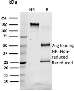 SDS-PAGE Analysis Purified SREBP1 Mouse Monoclonal Antibody (SREBP1/1578). Confirmation of Integrity and Purity of Antibody.