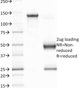 SDS-PAGE Analysis Purified EBV Mouse Monoclonal Antibody (CS1). Confirmation of Integrity and Purity of Antibody.