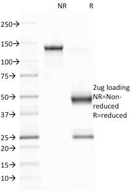 SDS-PAGE Analysis Purified EBV Mouse Monoclonal Antibody (CS1). Confirmation of Integrity and Purity of Antibody.