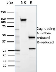SDS-PAGE Analysis Purified SREBP2 Mouse Monoclonal Antibody (SREBP2/1579). Confirmation of Purity and Integrity of Antibody.