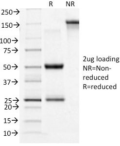 SDS-PAGE Analysis Purified CD71 Mouse Monoclonal Antibody (TFRC/1396). Confirmation of Integrity and Purity of Antibody.