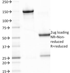 SDS-PAGE Analysis Purified EBV Mouse Monoclonal Antibody (CS2). Confirmation of Integrity and Purity of Antibody.