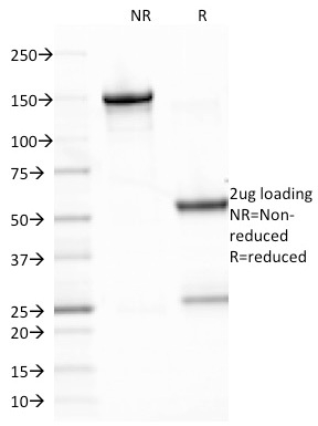 SDS-PAGE Analysis Purified EBV Mouse Monoclonal Antibody (CS2). Confirmation of Integrity and Purity of Antibody.