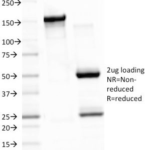 SDS-PAGE Analysis Purified EBV Mouse Monoclonal Antibody (CS3). Confirmation of Integrity and Purity of Antibody.