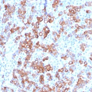 Formalin-fixed, paraffin-embedded human Adrenal stained with TIM3 Mouse Monoclonal Antibody (TIM3/3113).