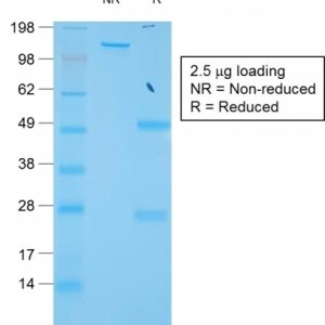 SDS-PAGE Analysis of Purified TIMP1 Rabbit Recombinant Monoclonal Antibody (TIMP1/1944R).