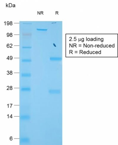 SDS-PAGE Analysis of Purified TIMP1 Rabbit Recombinant Monoclonal Antibody (TIMP1/1944R).