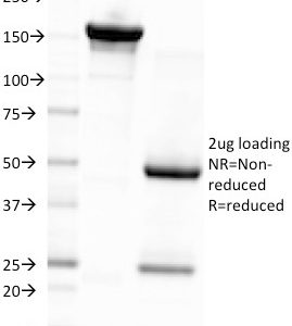 SDS-PAGE Analysis Purified EBV Mouse Monoclonal Antibody (CS4). Confirmation of Integrity and Purity of Antibody.