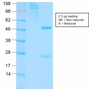 SDS-PAGE Analysis Purified p53 Rabbit Recombinant Monoclonal Antibody (TP53/3156R). Confirmation of Purity and Integrity of Antibody.