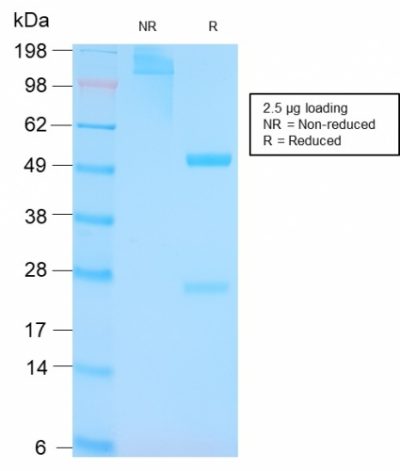 SDS-PAGE Analysis Purified p53 Rabbit Recombinant Monoclonal Antibody (TP53/3156R). Confirmation of Purity and Integrity of Antibody.