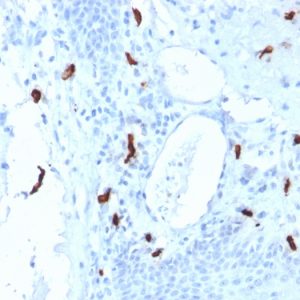 Formalin-fixed, paraffin-embedded human Tonsil stained with Tryptase Mouse Monoclonal Antibody (TPSAB1/1961).