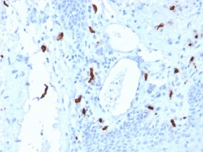 Formalin-fixed, paraffin-embedded human Tonsil stained with Tryptase Mouse Monoclonal Antibody (TPSAB1/1961).