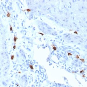Formalin-fixed, paraffin-embedded human Skin stained with Tryptase Mouse Monoclonal Antibody (TPSAB1/1963).
