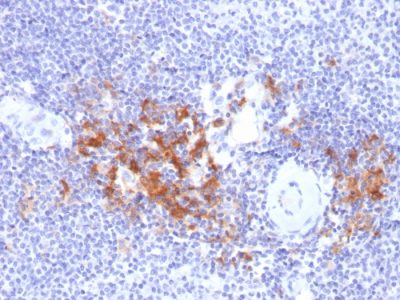 Formalin-fixed, paraffin-embedded human Spleen stained with TRAF1 Mouse Monoclonal Antibody (TRAF1/2770).