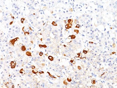 Formalin-fixed, paraffin-embedded human Pituitary stained with TSH beta Mouse Monoclonal Antibody (TSHb/1317).