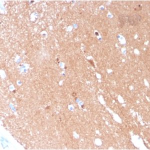 Formalin-fixed, paraffin-embedded human Brain stained with Tubulin beta 3 Mouse Monoclonal Antibody (TUBB3/3731).