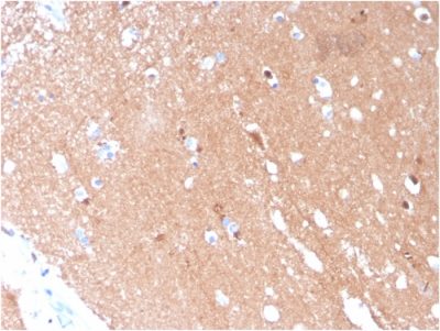 Formalin-fixed, paraffin-embedded human Brain stained with Tubulin beta 3 Mouse Monoclonal Antibody (TUBB3/3731).