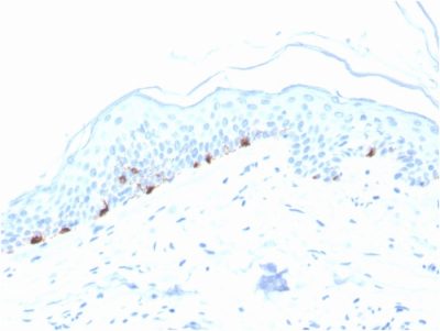 Formalin-fixed, paraffin-embedded human Skin stained with TYRP1-Monospecific Mouse Monoclonal Antibody (TYRP1/3280).