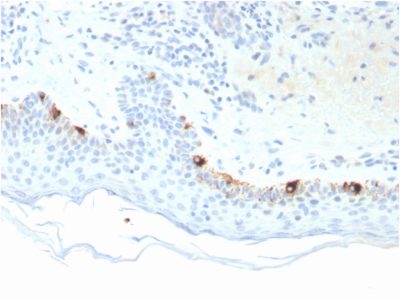 Formalin-fixed, paraffin-embedded human Skin stained with TYRP1-Monospecific Mouse Monoclonal Antibody (TYRP1/3281).