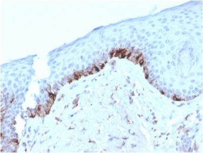 Formalin-fixed, paraffin-embedded human Skin stained with TYRP1-Monospecific Mouse Monoclonal Antibody (TYRP1/3282).