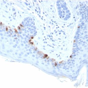Formalin-fixed, paraffin-embedded human Skin stained with TYRP1-Monospecific Mouse Monoclonal Antibody (TYRP1/3283).