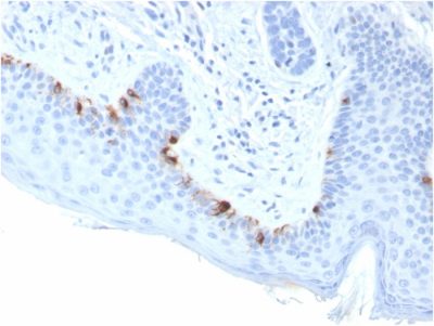 Formalin-fixed, paraffin-embedded human Skin stained with TYRP1-Monospecific Mouse Monoclonal Antibody (TYRP1/3283).