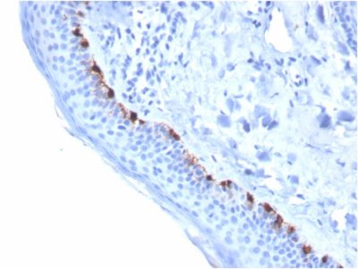 Formalin-fixed, paraffin-embedded human Skin stained with TYRP1-Monospecific Mouse Monoclonal Antibody (TYRP1/3284).