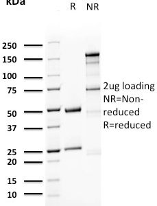 SDS-PAGE Analysis Purified Uroplakin 1A Mouse Monoclonal Antibody (UPK1A/2923). Confirmation of Purity and Integrity of Antibody.