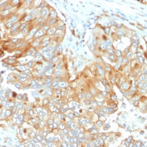 Formalin-fixed, paraffin-embedded human Endometrium stained with HLA-DR Mouse Monoclonal Antibody (DA2).