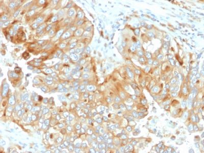 Formalin-fixed, paraffin-embedded human Endometrium stained with HLA-DR Mouse Monoclonal Antibody (DA2).